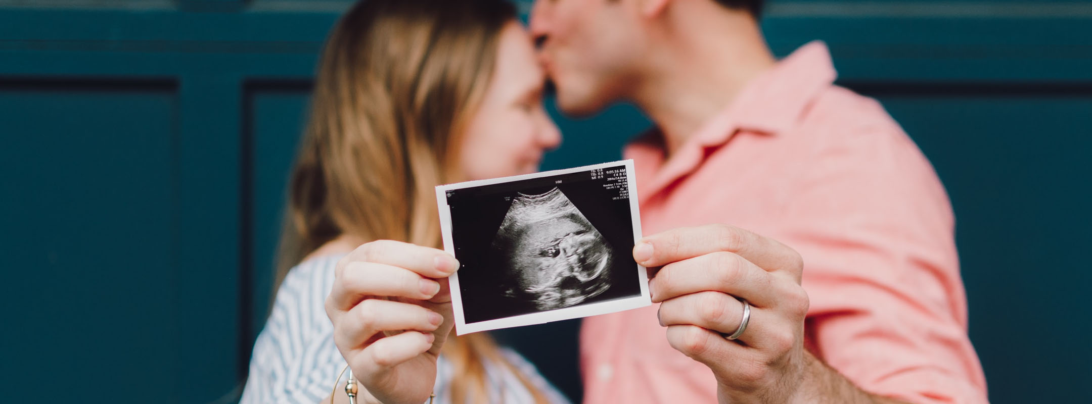 Ein verliebtes paar hält ein Ultraschallbild eines Babys.